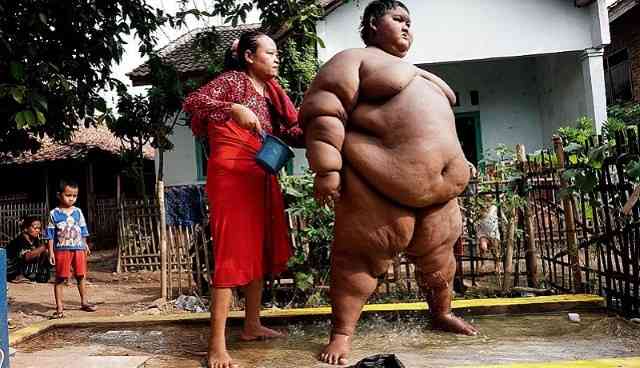 menino-mais-gordo-do-mundo Menino mais gordo do mundo tem 10 anos e pesa 192kg