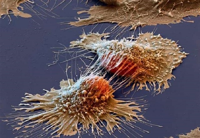 microscopio-eletronico-detecta-celulas-cancerigenas As 25 imagens mais incríveis que provavelmente você desconhecia